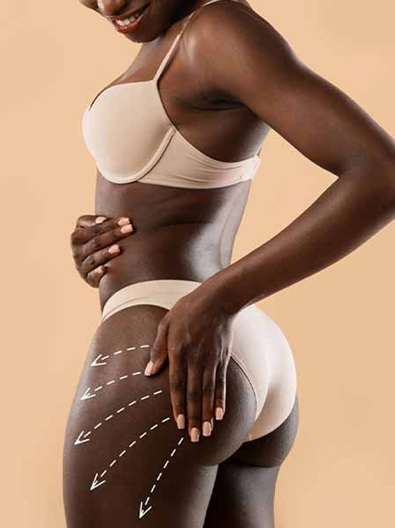 BODY